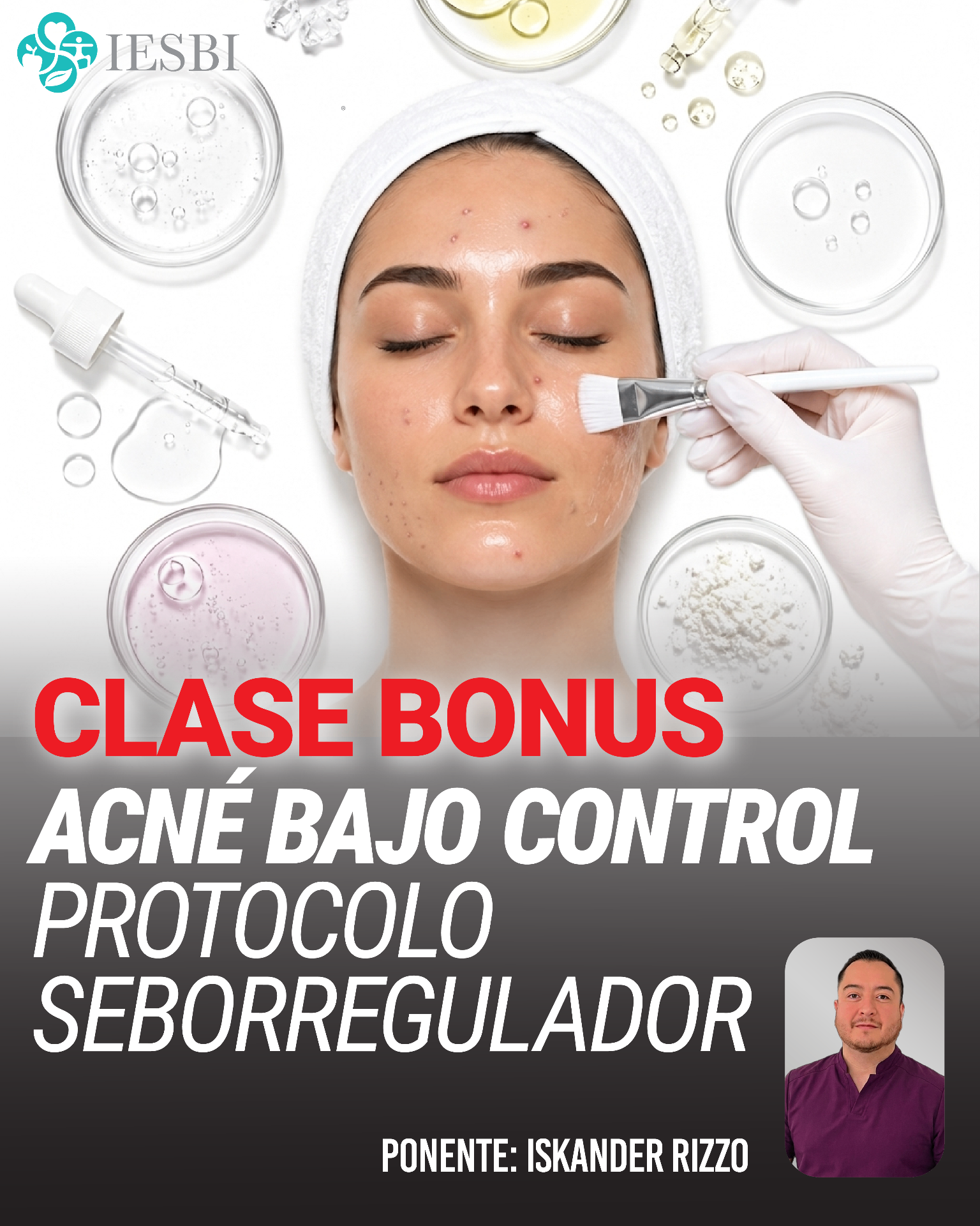 Clase Bonus: Acné bajo control - Protocolo seborregulador